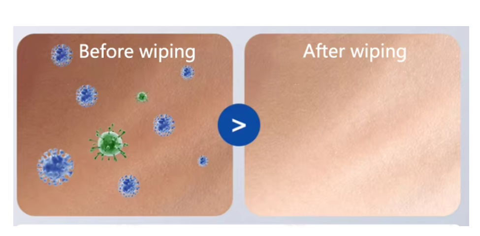 High Quality Factory Customization Sanitizing Wet Wipes small Alcohol Wipes Custom Sanitizers Wipes High Quality Factory Customization Sanitizing Wet Wipes small Alcohol Wipes Custom Sanitizers Wipes